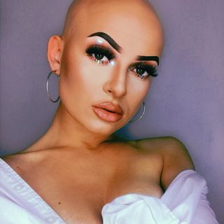 @alopecialovex