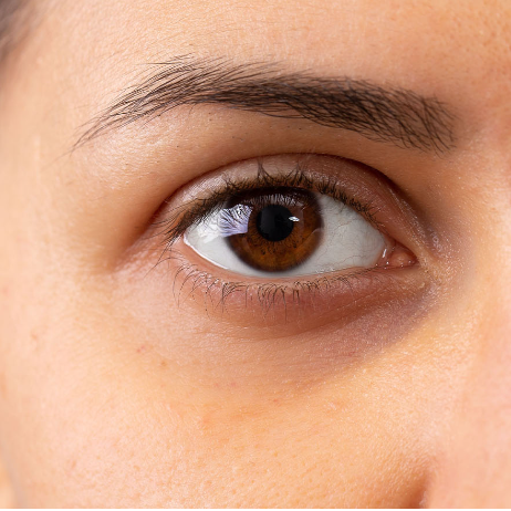 WHAT’S THE BEST WAY TO CONCEAL DARK CIRCLES?
