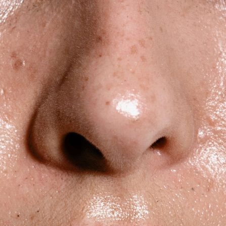 THE BEST CONCEALERS FOR OILY SKIN