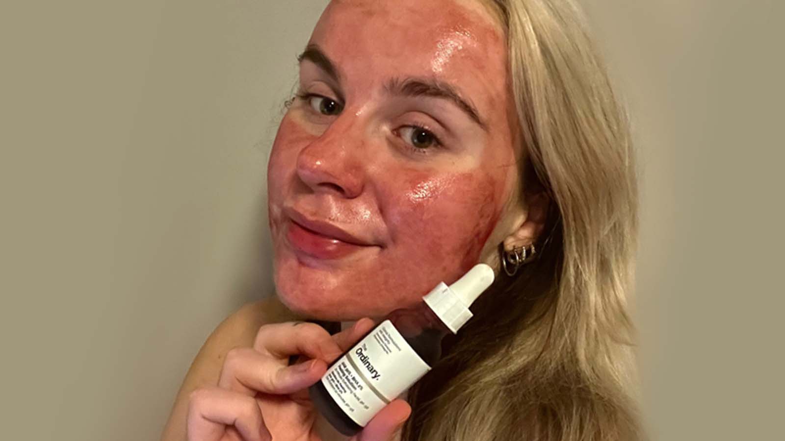 We&rsquo;re Obsessed With… This Viral Peeling Mask