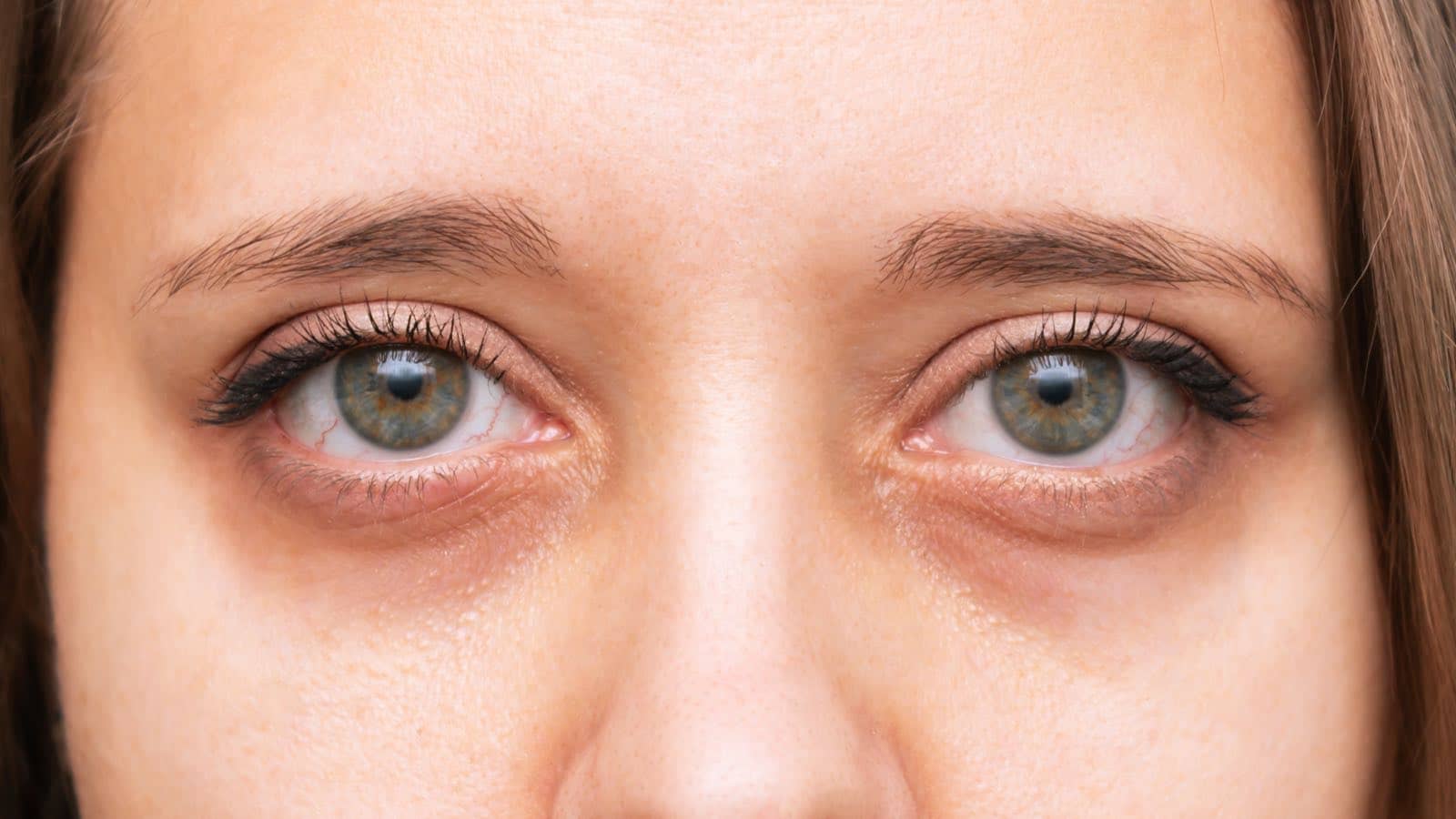 The Best Concealers For Dark Circles