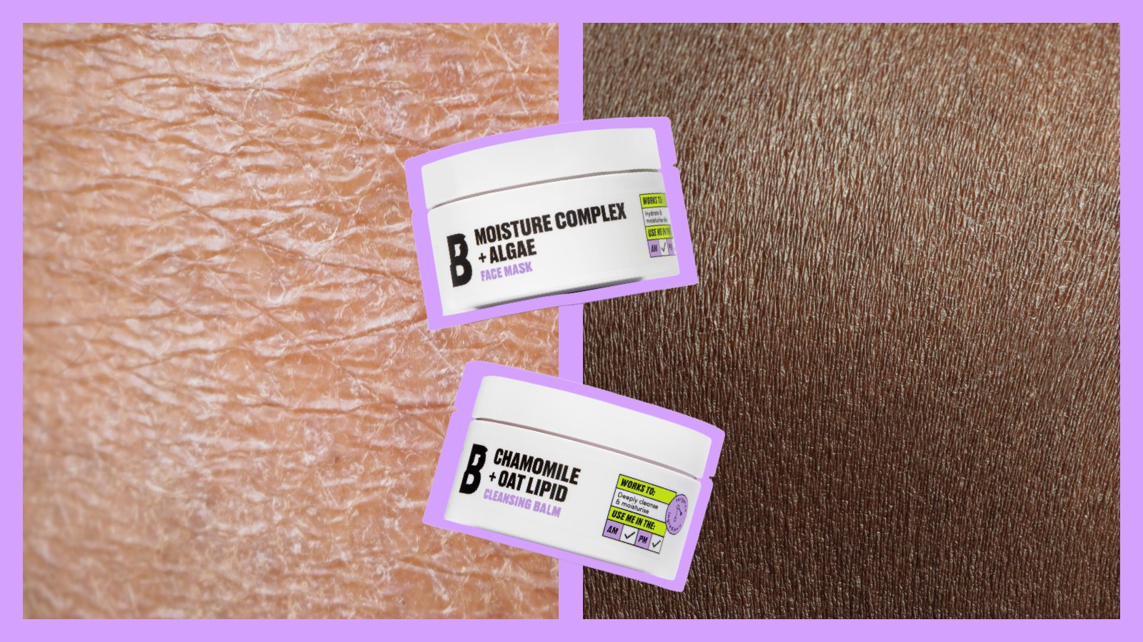 Ask Grace? Do I Have Dry or Dehydrated Skin?